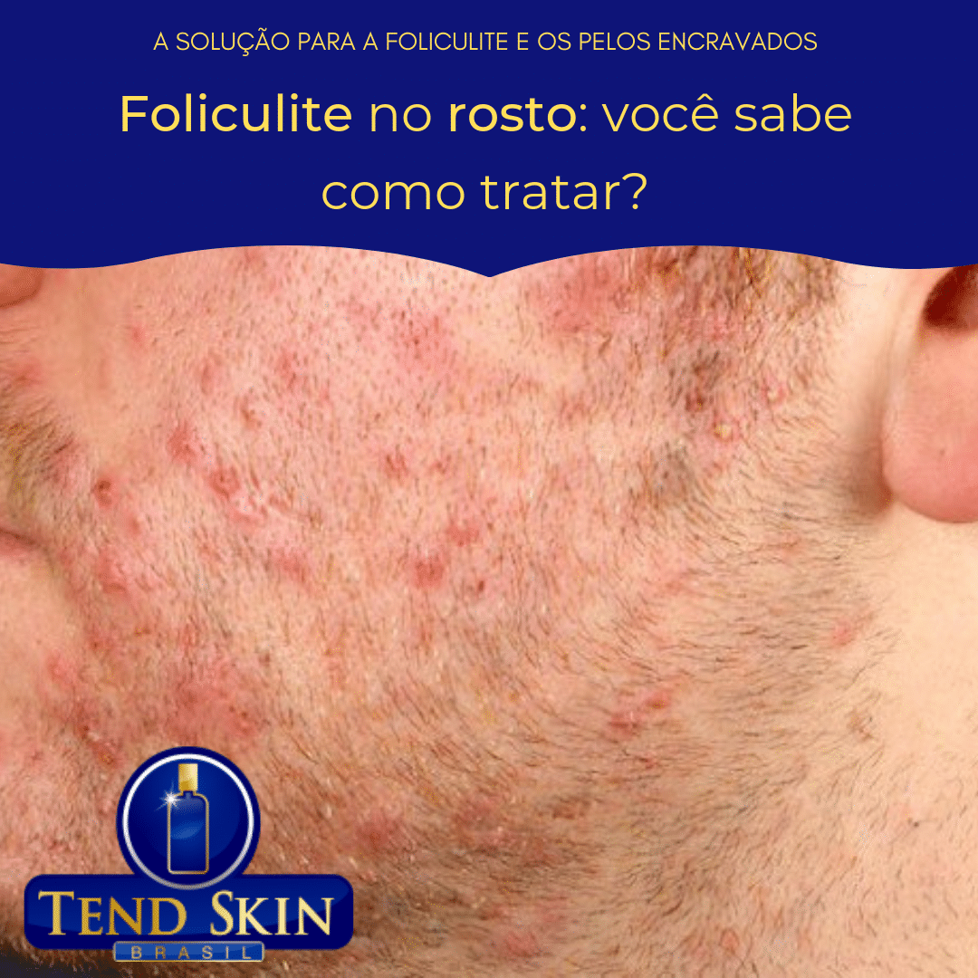 foliculite no rosto
