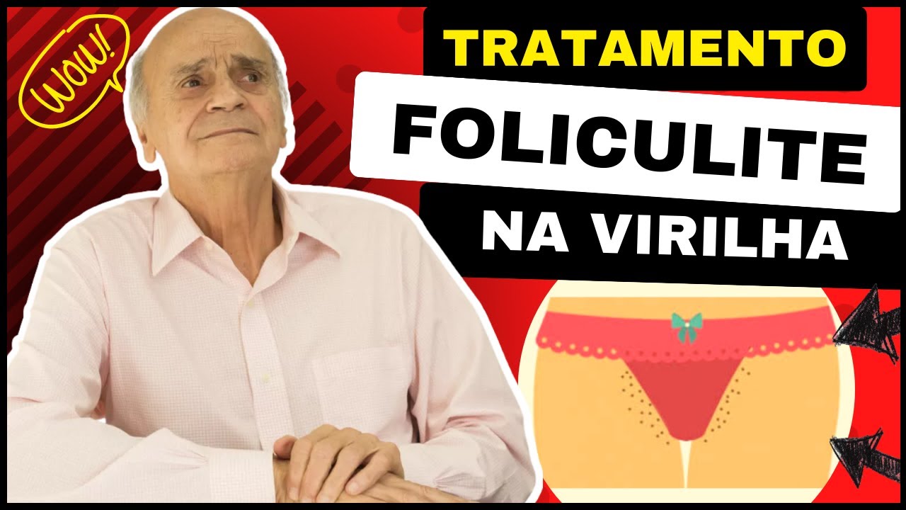Ilustração sobre foliculite na virilha: entenda o que é (fotos) e como tratar